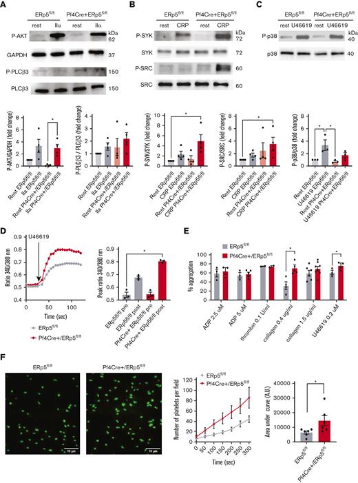 ERp5-deficient platelets have enhanced activation of collagen signaling pathways, increased Ca2+ mobilization and aggregation in response to U44619, and increased adhesion to fibrinogen under shear. (A) Representative immunoblots of P-AKT and P-PLCβ3 in response to IIα stimulation. Band densitometry of P-AKT expressed as a ratio to glyceraldehyde-3-phosphate dehydrogenase (GAPDH); P-PLCβ3 expressed as a ratio to total protein in lysates of control ERp5fl/fl (gray) and CKO Pf4Cre+/ERp5fl/fl (red) platelets treated with buffer (light box) or IIα (dark box). (B) Representative immunoblots of P-SYK and P-SRC in response to CRP stimulation. Band densitometry of P-SYK and P-SRC expressed as a ratio to the total protein in lysates of control (gray) and ERp5 KO (red) platelets treated with buffer (light box) or CRP (dark box). (C) Representative immunoblots of P-p38 and p38 in response to stimulation with 0.2 μm U46619. Band densitometry of P-p38 expressed as a ratio to the total protein in lysates of control (gray) and ERp5 KO (red) platelets treated with buffer (light box) or U46619 (dark box). All ratios are presented as fold change over buffer-treated controls. (D) Calcium flux, representative image, and peak Ca2+ flux after stimulation of platelets from control ERp5fl/fl (gray) or CKO Pf4Cre+/ERp5fl/fl (red) mice with U46619. (E) Aggregation (%) after activation with ADP, thrombin, collagen, and U46619. (F) Representative images of platelets labeled with calcein after perfusion on fibrinogen-coated microfluidic channels at a shear rate of 500 s−1 for 5 minutes. Kinetics of adhesion of washed platelets from control (gray) and CKO (red) mice. Area under the curve (AUC) of platelet surface fluorescence at the end of perfusion (300 seconds) for control (gray) and CKO (red) platelets. n = 3 to 4 per genotype for signaling proteins; n = 3 to 6 per genotype for Ca2+ flux, aggregation, and adhesion; mean ± SEM, Student t test (F), 1-way ANOVA with Dunn post hoc analysis (A-E). ∗P < .05.