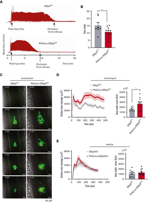 ERp5-deficient platelets have increased thrombotic tendency in vivo and enhanced thrombotic response after injection of tunicamycin. (A-B) Doppler tracing of blood flow after electrolytic injury to the carotid artery in ERp5fl/fl (control) and Pf4Cre+/ERp5fl/fl (CKO) mice (A) and time to occlusion after carotid electrolytic injury in control (gray) and CKO (red) mice (B); n = 6 to 11 per genotype. (C) Representative images of platelet (green) accumulation over time after laser injury of the mesenteric vein in a control and ERp5 CKO mouse injected with tunicamycin 24 hours prior. (D) Kinetics of mean ± SEM platelet accumulation over time as measured by fluorescence area and area under the curve (AU) of individual thrombi in control (gray) and CKO mice (red) after tunicamycin injection; n = 9 thrombi from 3 control mice and n = 13 thrombi from 4 CKO mice. (E) Kinetics of mean ± SEM platelet accumulation over time as measured by fluorescence area and AU of individual thrombi in control (gray) and CKO mice (red) after DMSO vehicle injection; n = 11 thrombi from 4 control mice and n = 13 thrombi from 4 ERp5 CKO mice, mean ± SEM, Student t test. ∗P < .05.