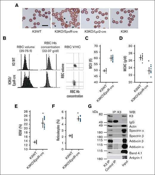 K3 is a constituent of erythrocyte junctional complexes, and its deficiency results in poikilocytosis and macrocytosis. (A) Representative images of mouse peripheral blood smears stained with Wright-Giemsa stain. Images were captured with ImageEM C9100-13 EMCCD monochrome camera using a Leica DMI6000 microscope equipped with an oil 40×/1.15 objective and LAS-X software. The images were processed with the Adobe Photoshop 7.0 software. Scale bar, 10 μm. (B) (left) Representative histograms of RBC volume and Hb concentration obtained via an automated complete blood count analysis of K3WT and K3KO/EpoR-cre peripheral blood with an Advia 120 Hematology System; right) the histograms from the left panel plotted as a RBC volume/hemoglobin concentration cytogram, normal K3WT RBCs fall into the central square. (C-F) Statistical comparison of MCV (C), MCHC (D), RDW values (E), and reticulocyte percentages (F) of K3WT and K3KO/EpoR-cre peripheral blood RBCs. ∗P < .001; K3KO∖EpoR-cre vs K3WT mice; n = 7 to 10 mice per group. (G) K3 forms complexes with proteins of erythrocyte junctional complexes. Western blot analysis of proteins coimmunoprecipitated with anti-K3 Ab from lysates of K3WT erythrocyte ghosts. MCHC, mean corpuscular hemoglobin concentration; MCV, mean corpuscular volume; RDW, RBC distribution width.