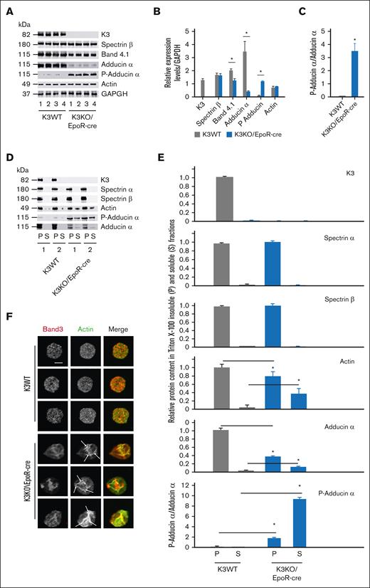 K3 maintains normal erythrocyte actin membrane skeleton. (A) Representative western blot analysis of major actin-binding proteins and adducin α phosphorylation in K3WT and K3KO/EpoR-cre erythrocyte ghosts. Samples from 4 different mice are shown. (B) Expression levels of actin-binding proteins in RBC ghosts from panel A, normalized to GAPDH. Densitometry of triplicate western blots was performed using Image J software. ∗P < .001; K3KO∖EpoR-cre vs K3WT mice; n = 12. (C) Densitometric analysis of phospho–adducin α (S724) normalized to total adducin α of triplicate western blots from panel A. ∗P < .001; n = 12. (D) Representative images of pellet (P) and Triton X-100–soluble (supernatant; S) fractions of erythrocyte ghosts from K3WT and K3KO/EpoR-cre mice examined using western blotting for the presence of K3, spectrins, actin, phosphorylated (S724), and total adducin α. Two mice per strain are shown. (E) Relative protein expression levels and phospho–adducin α (S724) in Triton X-100–insoluble and –soluble fractions of K3WT and K3KO/EpoR-cre erythrocytes. Optical density of each protein in Triton X-100–insoluble fraction (P) of K3WT RBC ghosts was assigned the value 1. Densitometric analysis of triplicate western blots for each protein for 3 mice per group was performed using Image J software. ∗P < .01; K3WT vs K3KO/EpoR-cre mice; n = 9. (F) Disorganized actin membrane cytoskeleton in K3KO/EpoR-cre erythrocytes. Adherent to poly-L-lysine K3WT and K3KO/EpoR-cre erythrocytes were stained for F-actin with phalloidin-Alexa Fluor 488 (green) and with anti–band 3 followed by Alexa Fluor 568 goat anti-rabbit immunoglobulin G (red). Images were taken with an HC PL APO 100×/1.47 oil objective using a Leica TCS-SP8-AOBS laser scanning confocal microscope using the LAS-X 3.5.7 software. Images are representative of 7 mice per group (scale bars, 2.5 μm). Arrows point to actin clamps and clusters.