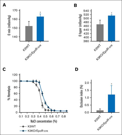 K3 deficiency impairs erythrocyte deformability and enhances osmotic fragility. (A,B) Osmotic gradient ektacytometry revealed increased Omin (A) and Ohyper (B) values in K3KO/EpoR-cre erythrocytes. Results are mean ± SD. ∗P < .05; n = 4; representative of 4 independent experiments. (C) Increased osmotic fragility of K3KO/EpoR-cre erythrocytes. Results are mean ± SD. ∗P < .05; n = 5; 3 independent experiments were performed. (D) Microfluidic assessment of erythrocyte deformability reveals an increased occlusion index. Results are expressed as mean ± SD. ∗P <.05; n = 5.