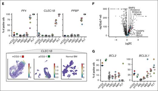 CG2 leukemia consists of immature megaerythroid stem and progenitor lineages. (A) Uniform manifold approximation and projection (UMAP) of normal BM lineages. The stem-megaerythroid compartment is circled, relevant populations are labeled, and differentiation trajectories are highlighted with arrows. (B) DEGs between cells of the megakaryocytic lineage (CD34+ MEPs, CD34+ MKPs, and platelets) and all other cell types in normal BM (supplemental Table 11). Genes relevant to the megakaryocytic differentiation are highlighted in red, and genes of the mitochondrial apoptotic pathway are highlighted in blue. (C, top) Percentage positive cells for each gene in mCG2s, pCG2s, other subtypes of AML and in specific populations of the normal BM (HSCs, MEPs, MKPs, and PLTs). The horizontal line represents the median of the group, the patient and models are color coded as in panel D, and the normal samples are color coded based on donor as in supplemental Figure 14D. (Bottom) ITGA2B (CD41) expression per cell on a UMAP representation of mCG2-1, pCG2-1, and normal BM (extended samples in supplemental Figures 15 and 16). (D) Radar plot (top) of lineage composition assessed by single-cell RNAseq in CG2 AMKL models and pediatric patients, as compared with diverse phenotypic and genetic subtypes of adult AML. The detailed proportion of each cell type is presented as stacked bar plots (bottom). Color coding of populations is as depicted in panel A. (E) Representation as in panel C of terminal differentiation gene expression (extended samples in supplemental Figures 15 and 16). (F) DEGs in the CD34+ MKPs from the mCG2 and pCG2s compared with those in normal CD34+ MKPs (supplemental Table 12). Selected markers are highlighted in red, and genes of the mitochondrial apoptotic pathway are highlighted in blue. (G) Representation as in panel C of BCL2 and BCL2L1 (BCL-XL) expression. ERP, erythroid progenitors; HSCs, hematopoietic stem cells; PLT, platelet.