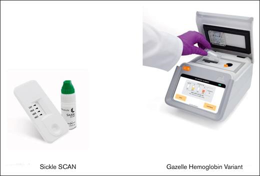 POC devices used to identify or quantify hemoglobins. Sickle SCAN (BioMedomics) detects hemoglobins A, S, and C, and Gazelle Hemoglobin Variant (Hemex Health) detects and quantifies different hemoglobins present in the samples.