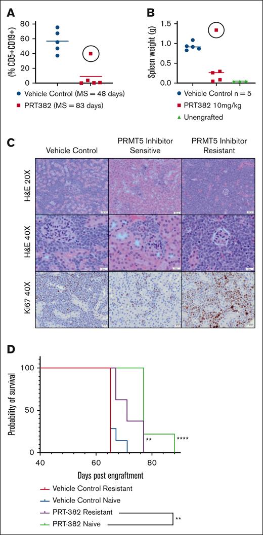 Development of PDX MCL model of PRMT5 inhibitor resistance. (A) Peripheral disease burden based on circulating neoplastic cells (CD5+/CD19+) cells in the PRT-382 (red) and VC (blue) treated cohort in the PDX MCL model. One PRT-382–treated mouse became resistant to therapy as evidenced by its increased peripheral disease burden (circle), (B) increased spleen weight in resistant mouse (circle), and (C) increased neoplastic infiltration and ki67 staining of the kidney via histopathology of the PRMT5 inhibitor–resistant mouse compared with those of both VC and other PRMT5 inhibitor–sensitive mice in its cohort; H&E, original magnification ×20 and ×40 and ki67, original magnification ×40×. (D) Kaplan-Meier plot of the in vivo experiment conducted to validate the PRMT5 inhibitor–resistant mouse. There is decreased survival (P = .005) despite PRT-382 treatment in mice engrafted with PRMT5 inhibitor–resistant (purple) vs PRMT5 inhibitor–naive (green) cells. Mice were engrafted on day 0 and treatment initiated on day 43 when PRT-382 10 mg/kg or vehicle was administered by mouth 4 days on and 3 days off. MS for PRMT5 inhibitor–resistant and –naive engrafted vehicle, 65 days; for PRMT5 inhibitor–resistant engrafted PRT-382, 71 days; and for PRMT5 inhibitor–naive engrafted PRT-382, 77 days. Unless otherwise indicated, significance is relative to the PRMT5 inhibitor–naive engrafted VC cohort; ∗∗P < .01. H&E, hematoxylin and eosin.