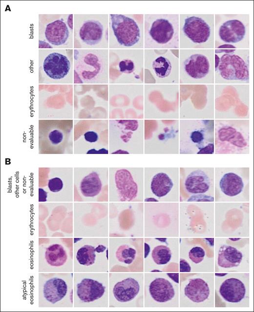Randomly sampled example image for the classes of the CFM. (A) Images for the 4 classes of the general CFM and (B) of the eCFM are shown.