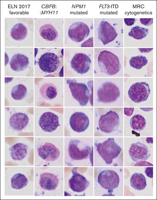 Highest scoring single-cell images from occlusion sensitivity analysis for the different genetic categories. The images represent the most important images for the decision toward a label.