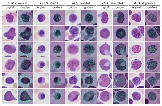 Single-cell saliency maps for different genetic categories. The importance of individual pixel for the classification decision are calculated based on gradient computations in the GFEN model and are overlaid onto the original image (high gradient: yellow to green).