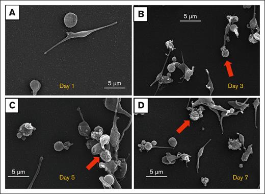 Apheresis PLT supernatant is composed of PSLPs with a broad size distribution. SEM images of PSLPs present in apheresis PLT supernatant on days 1 (A), 3 (B), 5 (C), and 7 (D). PLTs with fragmented membranes are indicated by red arrow.