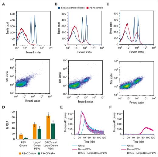 FC analysis of PSLP populations isolated by density gradient. Distribution and scatter plots of (A) PEV ghosts, (B) large/dense PEVs, and (C) DPLTs and large/dense PEVs. FC analysis of percentage of PS+CD62P+ PSLPs and PS+CD41a+ PSLPs present in the PSLP populations isolated by density gradient (D). N = 3, t test; P < .05 considered significant. TG assay demonstrates the procoagulant activities of PSLP populations isolated by sucrose density gradient. TG curves for PSLPs in the absence (E) and presence of 10 μmol/L of lactadherin (F), representative of 3 individual experiments and 3 individual donors. The same volume (50 μL) of each PSLP fraction was used in the experiment. RFU, relative fluorescence units.