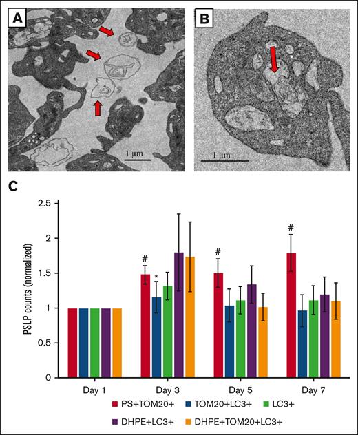 Apheresis PLTs release mitochondria (MITO) during storage at RT. TEM image of (A) extracellular MITO in apheresis PLT supernatant on day 7 of storage and (B) a mitochondrion in an autophagic vacuole. Red arrows indicate mitochondria. FC analysis of (C) PS+TOM20+TOM20+LC3+, DHPE+LC3+, and DHPE+TOM20+LC3+ PSLPs. There is an increase in PS+TOM20+ PSLPs with storage time. The counts of mitophagy-related PSLPs do not significantly change during storage. FC data are expressed as the fold change in the count of small and large PEVs normalized to that of from day 1 PLT bag (mean ± SE) (#P < .01; ∗P < .05; N = 12).