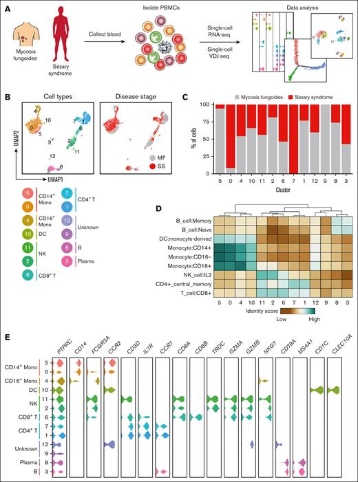 An atlas of peripheral immune cells in MF and SS. (A) Experimental schematic depicting the overall study design. (B) UMAP representations of integrated single-cell transcriptomes derived from the peripheral blood of patients with MF and SS. (C) Bar plots of the proportion of each cluster identified in panel B for patients with MF and SS. (D) Heat map of the identity score for the indicated immune cell type for each cluster identified in panel B. (E) Violin plots of selected genes for multiple immune cell types.
