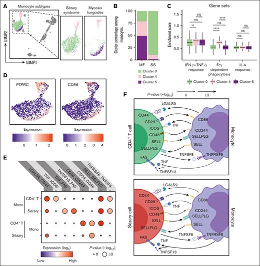 Emergence of exhausted monocytes with unique intercellular interactions in SS. (A) UMAP plot demonstrating 3 clusters of monocytes. Cells are color coded by clusters. (B) Bar plots enumerating the proportion of monocytes in the indicated cluster for patients with MF and SS. (C) Box plots comparing enrichment scores for the indicated phenotype among cells in the indicated cluster. Center line, median; box limits, upper and lower quartiles. ∗∗P < .01; ∗∗∗∗P < .0001 by 2-tailed t test with Bonferroni multiple comparisons correction. (D) UMAP plots showing the expression of selected surface markers in all monocyte clusters. (E) Dot plot of the predicted interactions between monocytes and the indicated immune cell types. P values are indicated by the circle sizes, as shown in the scale on the bottom right (permutation test). The means of the average expression level of each interacting molecules are indicated by the color. (F) Cartoon depicting the potential receptor/ligand interactions between monocytes and other types of peripheral immune cells. ns, nonsignificant.