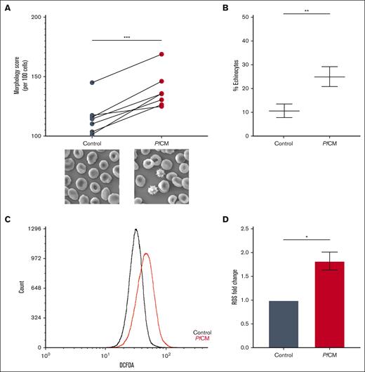 PfCM increases RBC echinocytosis and intracellular ROS. RBCs incubated in control medium or PfCM overnight were imaged using scanning electron microscopy (AMRAY 1810×, 2000× total original magnification) and assessed based on (A) morphology scores and (B) percentage echinocytes (n = 7). RBCs incubated in control medium or PfCM overnight were washed after incubations and stained with DCFDA to quantify intracellular ROS using flow cytometry. Representative flow cytometry histogram shown (C) and bar graph of ROS fold change compared with the control (D); n = 4. Mean ± standard error of the mean denoted by error bars. A 1-way paired t test was used to analyze the data. ∗P < .05; ∗∗P < .005; ∗∗∗P < .0005.