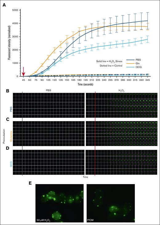 QCG supplementation rapidly protects RBCs from intracellular ROS formation during oxidative stress. RBCs pretreated with either PBS, Gln (Q), or QCG were labeled with DCFDA, placed in a glass bottom petri dish per sample condition, and allowed to settle for 45 seconds before given a bolus (red arrow, A) of PBS (gray line, B-D) or 50 μM H2O2 (red line, B-D). Stationary cells (total 8 cells per condition) were quantified (A) and imaged (B-D) per condition at each 15 second time point for 5 minutes. Images were taken with a Leica Thunder at 63× oil immersion (A-D). Representative images of DCFDA labeled RBCs stressed with 50 μM H2O2 (left) or PfCM (right) (E). Images taken with Echo Revolve fluorescent microscope at 100× oil immersion (E).
