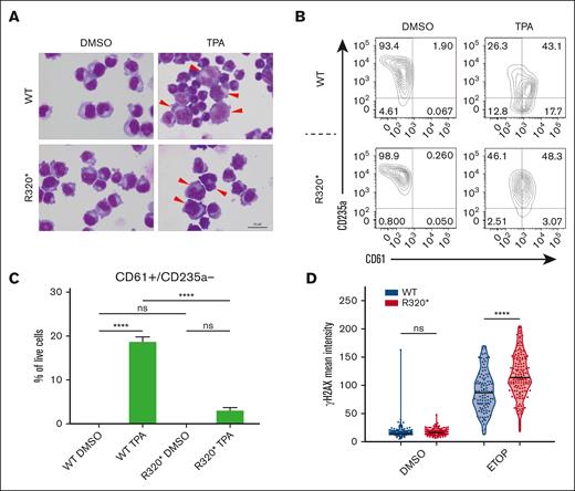 RUNX1R320∗ results in differentiation block and increased DNA damage sensitivity. (A) Representative images of RUNX1 wild-type and RUNX1R320∗ cells treated with DMSO or 10 nM TPA for 48 hours. Differentiating cells are denoted with arrows. (B-C) Representative flow cytometry analysis of RUNX1 wild-type and RUNX1R320∗ K562 cells which were treated with DMSO and 5 nM TPA for 48 hours. The MK marker CD61 (integrin β3 chain) was analyzed, along with the erythroid marker CD235a (glycophorin A). Live cells were divided into 4 groups using the FACS diva software based on the presence (+/−) of CD61 and CD235a. DMSO-treated control cells were compared with TPA-treated cells for both the RUNX1 wild-type and RUNX1R320∗ genotypes (n = 3). Significance was determined using 2-way ANOVA. (D) DNA damage levels in RUNX1 wild-type and RUNX1R320∗ cells upon treatment with ETOP and CPT relative to the DMSO control. The cells were treated with 25 μM ETOP or CPT for 1 hour at 37°C before fixation and staining. DAPI was used to identify the nuclei of cells and the γH2AX mean signal intensity was measured per cell within the nucleus. Student t test was used to determine significance. ∗ P ≤ .05; ∗∗ P ≤ .01; ∗∗∗ P ≤ .001; ∗∗∗∗ P ≤ .0001. DMSO, dimethyl sulfoxide; FACS, fluorescence-activated cell sorting; DAPI, 4′,6-diamidino-2-phenylindole.