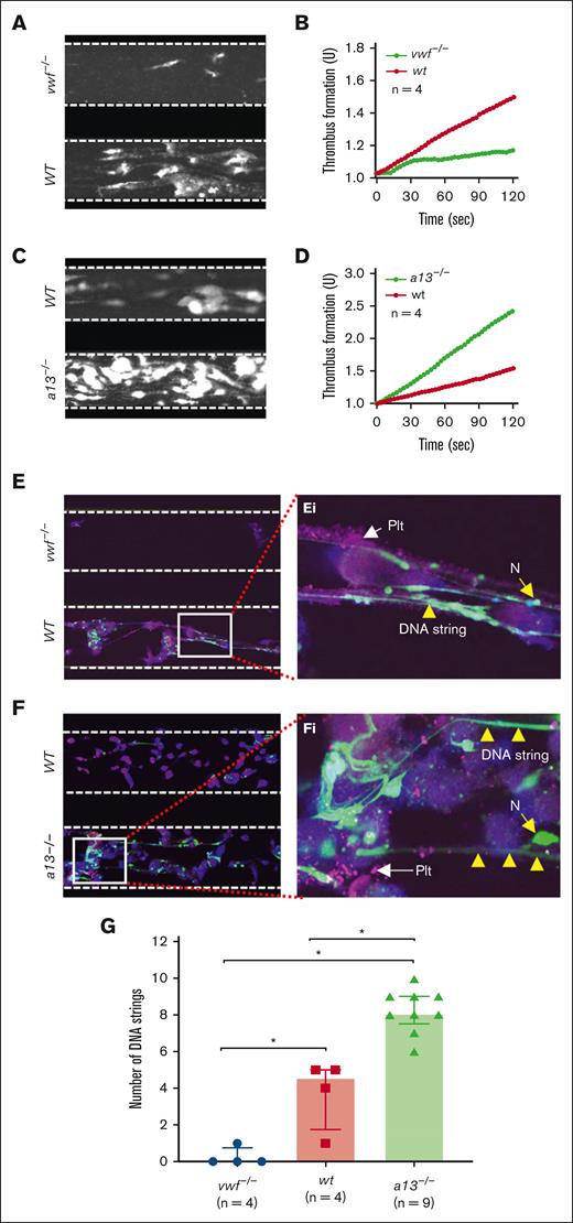Microfluidic assay determines ex vivo thrombus and NETs formation under arterial flow in vwf-/- and Adamts13-/- mice. (A-B) The final mean surface coverage of platelets and leukocytes on the collagen surface and the mean rate of thrombus formation over time, respectively, following perfusion of whole blood prestimulated with Stx-2 under flow from vwf-/- (top) and WT (bottom) mice, as indicated. (C-D) The final surface coverage of platelets and leukocytes and the rate of thrombus formation over time, respectively, following perfusion of whole blood prestimulated with Stx-2 from WT (top) and Adamts13-/- (bottom) mice, as indicated. (E-F) Representative confocal microscopic images demonstrate the finally adhered platelets (purple), neutrophils (green), and extracellular DNA strings (elongated green) following perfusion of whole blood samples from vwf-/- vs WT, and WT vs Adamts13-/- mice, respectively. (Ei-Fi) are enlarged (5×) areas from the bottom panels of E and F, respectively. Here, a13-/- is Adamts13-/-; vwf-/- is vwf null; n, number of mice; N, neutrophil; PLT, platelets. (G) Quantitation of the number of DNA strings under fluorescent microscope in the blood samples from vwf-/-, WT, and Adamts13-/- mice. The data shown in G are individual values (dots), median (bar), and interquartile range (IQR). Kruskal-Wallis test determined the statistical significance among the 3 groups. ∗ indicates P < .05.