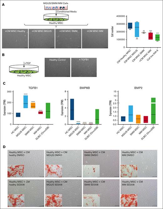 Blocking of the potential candidate TGFB in supernatants derived from MGUS, SMM and MM restores differentiation capacity of co-cultured healthy MSC. (A) Study design for coculture of healthy MSC with conditioned media (CM) from MGUS, SMM, and MM patients. MSC were cultured with CM from healthy, MGUS, SMM, or MM MNC for 3 days. Representative micrographics of the phenotype of healthy MSC after exposure to supernatants from MGUS-, SMM-, and MM-derived MNC for 3 days with scale bars indicating 100 μm. Bar charts of cell number after exposure to supernatants from MGUS, SMM, and MM MNC as well as the MM cell line INA-6. (B) Healthy MSC were treated 3 days with TGFB1 and representative pictures show phenotype of untreated healthy control and after exposure to TGFB1. Scale bars indicating 100 μm. (C) Expression TPM-values (transcripts per kilobase million) from our RNA sequencing data for TGFB1, BMP8B, and BMP2 from our MGUS, SMM, and MM MSC samples in comparison to 48 patients samples with diffuse large B-cell lymphoma from the database OncoDB. (D) Coculture of healthy MSC with CM from healthy, MGUS, SMM, and MM MNC. To analyze and inhibit potential TGFB1 inducing effects, the potent ATP-competitive TGF-βRI inhibitor SD208 was added to CM from healthy, MGUS, SMM, and MM-derived MNC. DMSO containing CM served as control group. Healthy MSC were co-cultured with respective CM for 3 days. Representative micrographs of the morphology of healthy MSC cocultured with CM supplemented with DMSO or SD208 are shown. Inner pictures show Alizarin Red staining of 14 days osteogenic induced healthy MSC after the period of 3 days of exposure to respective condition (CM MGUS, SMM, MM + DMSO, or +SD208). Scale bars indicating 100 μm.