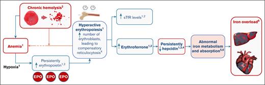 Pathophysiology of iron overload in PK deficiency. 1, Adapted from Grootendorst et al1; 2, adapted from Zaninoni et al7; 3, adapted from van Vuren et al6; 4, adapted from Finkenstedt et al17; 5, adapted from Gupta et al18; 6, adapted from Coffey and Ganz.19 EPO, erythropoietin.