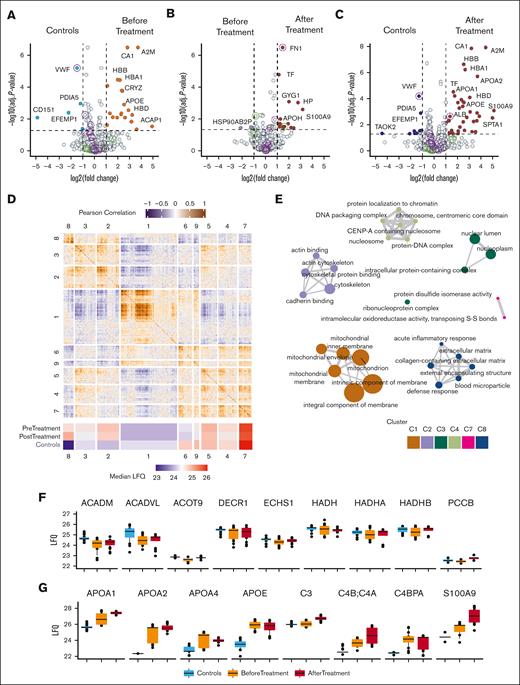 Proteomic landscape of platelets from controls and patients before and after treatment. (A) Volcano plot comparing the platelet proteomes of patients with sitosterolemia before treatment and healthy controls. Upregulated proteins in patients are shown in orange, whereas downregulated proteins are shown in blue. (B) Volcano plot comparing proteomic profiles of patients before and after treatment. Upregulated proteins after the treatment are shown in red. (C) Volcano plot comparing the platelet proteomes of patients with sitosterolemia after treatment and healthy controls. Upregulated proteins in patients are shown in red, whereas downregulated proteins are shown in dark blue. (A-C) Circles are drawn around granule-derived proteins: purple = alpha granules; green = dense granules. The difference in the expression is shown on the x-axis, and the logarithmic P value (–log(P value)) is shown on the y-axis. Dotted lines indicate the threshold of significance with the horizontal line marking a –log10 (adjusted P value) of 1, and the vertical dotted lines marking a log2(fold change) of 1. For a complete list of the significantly regulated proteins, refer to the supplemental Tables. (D) Heat map of Pearson correlation coefficient of the pairwise comparison of all quantified proteins in this study. The row and column splits are based on WGCNA-defined functional modules, which are numbered. Color gradients denote coefficients (purple: −1, white: 0, orange:1). A heat map of the median module intensity per condition is annotated below. Colors reflect the LFQ intensity. (E) GO term enrichment of functional modules. Color indicates module, node size indicates amount of proteins with a GO term annotation, and edge width denotes GO term similarities based on Jaccard’s similarity. (F-G) Box plots showing protein intensities (LFQ) of a selection of proteins in module 8 associated with an inflammatory response (F) or blood microparticles (G). The black dots represent the individual measurements.