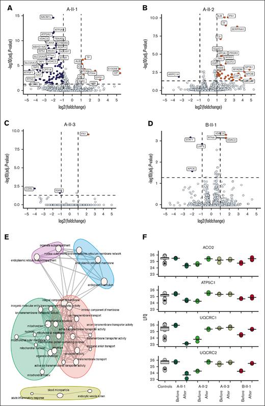 Proteomic landscape of platelets from controls and patients before and after treatment. Volcano plot comparing proteomic profiles before and after treatment of individual patients. (A) Index case A-II-1. (B) Index case A-II-2. (C) Index case A-II-3. (D) Index case B-II-1. Upregulated proteins in patients are shown in orange, whereas downregulated proteins are shown in dark blue. Difference in expression is shown on the x-axis, and the logarithmic P value (–log(P value)) is shown on the y-axis. Dotted lines indicate the threshold of significance with the horizontal line marking a –log10 (adjusted P value) of 1, and the vertical dotted lines marking a log2(fold change) of 1. (E) GO term enrichment of functional modules. Color indicates module, node size indicates amount of proteins with a GO term annotation, and edge width denotes GO term similarities based on Jaccard’s similarity. (F) Box plots showing the protein intensities (LFQ) of a selection of mitochondrial proteins. Black dots represent individual measurements.