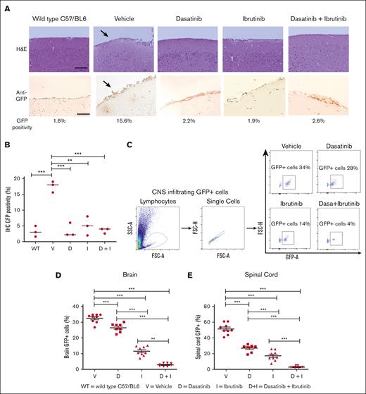 Decrease of CNS infiltration of leukemia cells by combination therapy with dasatinib and BTKi. (A) Upper panels, images of mouse brain rostral leptomeninges slices from WT C57/BL6 mice, vehicle-, dasatinib-, ibrutinib-, and dasatinib + ibrutinib–treated mice tissues, stained using the hematoxylin and eosin (H&E) method. Vehicle-treated mice show an increased level of leukemic infiltration (arrow) compared with the dasatinib-, ibrutinib-, and dasatinib + ibrutinib–treated mice. Samples were collected from sacrificed animals with signs of disease from vehicle- (mean = 18 days), dasatinib (mean = 24 days), ibrutinib (mean = 30 days), and dasatinib + ibrutinib (mean = 37 days) treated animals. Objective lens: 40×; scale bar: 50 μm. Lower panels, immunohistochemical staining of CNS sections with anti-GFP antibody showing less GFP+ E2A-PBX1+/preBCR+ leukemic cells infiltration in double- and single-treated mice compared with vehicle-treated mice. Arrows pointing at leukemic CNS infiltration. Unstained CNS sections are showed. Objective lens: 20×; scale bar: 200 μm. (B) GFP positivity from 3 representative mice of each group was estimated after transformation of images to DAB and GFP staining intensity quantified by a single cutoff threshold of 0.20. Statistical analysis was performed by 1-way analysis of variance (ANOVA), Dunnett multiple comparison test. (C) Single-cell suspensions from fresh tissue from both brain and spinal cord after cutting into small pieces by scalpel and resuspended in a cell dissociation solution were used for quantification of GFP+ cells in flow cytometry. Panels show the gating strategy for phospho-flow cytometry staining for GFP+ murine E2A-PBX1+/pre-BCR+ leukemia cells from vehicle-, dasatinib-, ibrutinib-, and dasatinib + ibrutinib–treated mice. Gating was performed on lymphocytes, single cells, and GFP+ cells. The frequency of GFP+ murine E2A-PBX1+/preBCR+ leukemia cells decrease in the combination treatment. (D-E) Frequency of GFP+ murine leukemia infiltrating (D) the brain and (E) the spinal cord of C57BL/6 WT, mice. Each symbol represents an individual mouse. Statistical analysis was performed by 1-way ANOVA, Dunnett multiple comparison test. Scatter dot plots represent mean ± SEM. ∗∗P < .01; ∗∗∗P < .0001. IHC, immunohistochemistry; WT, wild type.