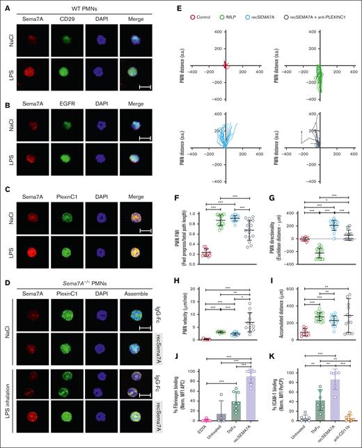 Sema7A binds to neutrophil PlexinC1 and influences neutrophil chemotaxis. Stained neutrophils isolated from saline (NaCl)- or LPS–treated WT and Sema7A−/− mice 4 hours after incubation. (A) Expression of Sema7A (red) and CD29 (green) on PMNs harvested from WT mice treated with NaCl or LPS (scale bar, 10 μm). (B) Expression of Sema7A (red) and EGFR (green) on PMNs harvested from WT mice treated with NaCl or LPS. No protein colocalization was visible in the merged pictures in either condition (scale bar, 10μm). (C) Expression of Sema7A (red) and PlexinC1 (green) on PMNs harvested from WT mice treated with NaCl or LPS. Sema7A expression is highly increased in LPS–treated mice, and the merged pictures show a strong interaction between Sema7A and PlexinC1 (scale bar, 10 μm). (D) Surface PMN expression of Sema7A (red) and PlexinC1 (green) in Sema7A−/− mice after the injection of exogenous recombinant Sema7A or IgG-Fc (control) after LPS or NaCl (controls) inhalation. Strong binding of exogenous Sema7A to Sema7A−/− PMNs was observed in LPS inhalation group. Multiple acquisitions of stained cells were analyzed from independently performed triplicate experiments (scale bar, 10 μm). (E) Human PMNs were subjected to different stimuli in bidirectional chemotactic chambers. Acquired time lapse videos over a 3-hour period were analyzed. Representative plots of PMN chemotactic tracks toward NaCl (control; red), fMLP (green), recombinant human SEMA7A (recSema7A; blue), or recSema7A together with antibodies against human PlexinC1 (anti-PLEXINC1; gray). (F-I) Comparison of the chemotaxis parameters forward migration index (FMI), Euclidean distance under the aspect of the direction, PMN velocity, and accumulated PMN distance. (J) PMN binding affinity was indicated by APC−labeled fibrinogen on the surface of Ly6G-positive PMNs, as analyzed by FACS. The EDTA group was the internal negative control to measure the baseline autofluorescence, the untreated group was the fibrinogen-negative control, TNF-α was used as a potent PMN stimulator, and treatment of PMNs with recombinant SEMA7A before APC−labeled fibrinogen represented the fibrinogen binding target group of interest. The fibrinogen-APC MFI was normalized and is displayed as a percentage. (K) PMN binding affinity was indicated by PerCP-labeled ICAM-1 on the surface of Ly6G-positive PMNs by FACS. The untreated group was the ICAM-1–negative control, TNF-α was used as a potent PMN stimulator, and treatment of PMNs with recombinant SEMA7A before PerCP-labeled ICAM-1 represented the ICAM-1 binding target group of interest. CD11b antibody treatment was used as a control for the inactivation of ICAM-1 binding. The ICAM-1 PerCP MFI was normalized and is displayed as a percentage. In (F-K), all group comparisons were performed by unpaired 2-tailed Student t tests (the data are the mean ± SD); ∗P < .05; ∗∗P < .01; ∗∗∗P < .001 as indicated. MFI, Mean Fluorescence Intensity.