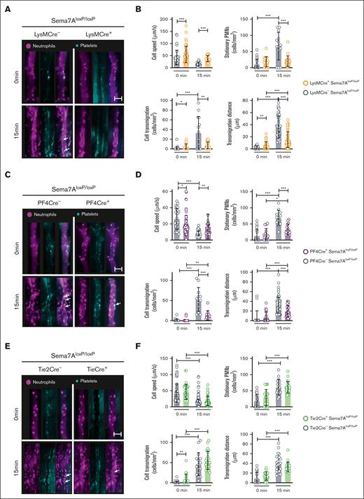 Tissue-specific expression of Sema7A controls neutrophil migration in response to inflammation. Intravital microscopic analysis of murine cremaster tissue after IV. LPS stimulation shows the role of Sema7A expression in different cells during inflammation. (A) Representative video images of the microvasculature of LysMCre+Sema7AloxP/loxP mice and littermate controls exposed to LPS for 15 minutes compared with the baseline control (0 min; scale bar, 50 μm). (B) Cell speed, transmigration, transmigration distance, and stationary PMNs in LysMCre+Sema7AloxP/loxP and littermate controls were analyzed by intravital microscopy after exposure to LPS for 15 minutes and compared with the baseline control (0 min). (C) Representative video images of the microvasculature of PF4Cre+Sema7AloxP/loxP mice and littermate controls exposed to LPS for 15 minutes compared with the baseline control (0 min; scale bar, 50 μm). (D) Cell speed, transmigration, transmigration distance, and stationary PMNs of PF4Cre+Sema7AloxP/loxP mice and littermate controls were analyzed by intravital microscopy after exposure to LPS for 15 minutes and compared with the baseline control (0 min; scale bar, 50 μm). (E) Representative video images of the microvasculature of Tie2Cre+Sema7AloxP/loxP mice and littermate controls exposed to LPS for 15 minutes and compared with the baseline control (0 min). (F) Cell speed, transmigration, transmigration distance, and stationary PMNs in Tie2Cre+Sema7AloxP/loxP and littermate controls were analyzed by intravital microscopy after exposure to LPS for 15 minutes and compared with the baseline control (0 min). Triplicate experiments were performed, and multiple cells were tracked for 15 to 20 minutes after LPS incubation over periods of 10 seconds at 90 fps. From the acquired videos, cells were tracked manually, and relevant group comparisons were performed by unpaired 2-tailed Student t tests (the data are the mean ± SD). ∗P < .05; ∗∗P < .01; ∗∗∗P < .001 as indicated, (arrows mark PNCs).