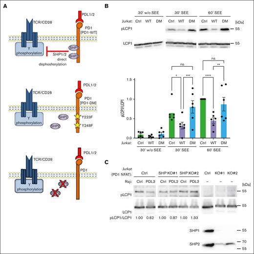 PD1-triggered inhibition of LCP1 phosphorylation is SHP1/SHP2-dependent. (A) Overview of the Jurkat cell lines used to assess the relevance of SHP1/2 phosphatases in the PD1-induced dephosphorylation of cytoskeleton proteins. Upper section: Ctrl cells expressing WT PD1. Middle section: Jurkat cells expressing PD1 DM, Y223F/Y248F, unable to bind SHP1/SHP2. Lower section: CRISPR/Cas9-mediated silencing of SHP1 and SHP2 in Jurkat-PD1-NFAT cells. (B) Upper panel: western blot monitoring phosphorylation of S5 of L-plastin (pLCP1) in the indicated cell lines. Jurkat-PD1 WT and Jurkat-PD1 DM cells were cocultured for the indicated times with PDL2–expressing Raji cells (Raji PDL2) in presence or absence of SEE at 6 ng/mL. Lower panel: quantification of experiments, pS5 LCP1 was normalized to total LCP1 for the 60-minute condition for 6 independent experiments. (C) Western blot monitoring phosphorylation of S5 of L-plastin (pLCP1) in 2 independent Jurkat-PD1-NFAT cell lines stably transduced with SHP1- and SHP2–specific CRISPR constructs and cocultured for 30 minutes with Raji Ctrl cells or Raji PDL2 in presence of SEE at 6 ng/mL. Representative data from 4 independent experiments.