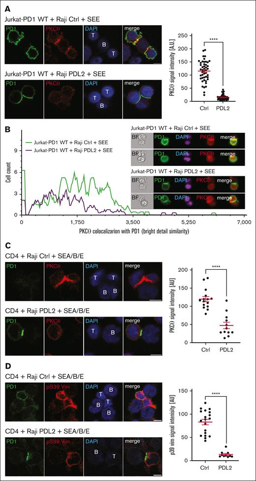 PD1 triggering affects PKCθ recruitment and vimentin phosphorylation at the IS. (A) Left: immunofluorescent labeling of PD1 and PKCθ upon 60 minutes of coculture of Jurkat-PD1 WT cells with Raji Ctrl cells (upper panel) or PDL2 expressing Raji cells (lower panel), preincubated with 6 ng/mL of SEE and mixed with Jurkat-PD1 WT cells at a 1:1 ratio. Right: quantification of the PKCθ signal intensity in Jurkat cells within proximity of the T and B cell interface from 1 experiment. Representative results of 4 independent experiments are shown. Each dot represents a value from 1 Jurkat cell, 46 and 56 cells were quantified, respectively. (B) ImageStream-based quantification of the colocalization between PD1 and PKCθ in Jurkat-PD1 WT cells cocultured for 60 minutes with Raji Ctrl or Raji PDL2 cells, preincubated with 6 ng/mL of SEE and mixed with Jurkat-PD1 WT cells at a 1:1 ratio. Upon fixation and permeabilization, samples were stained for PKCθ, PD1 and nuclei (DAPI) and analyzed by ImageStream flow cytometry. Left: histogram measuring the extent of signal overlap between PKCθ and PD1, with PD1 signal in the IS used as a mask; right: examples of images acquired. Representative results of 2 independent experiments are shown. (C) Left: immunofluorescent labeling of PD1 and PKCθ upon 30 minutes of coculture of human primary CD4 T cells with Raji Ctrl cells (upper panel) or Raji PDL2 cells (lower panel). Raji cells were preincubated with 1 ng/mL of SEA/SEB/SEE and mixed with CD4 cells at a 1:2 (Raji:T cells) ratio. Images shown are from a single Z plane, which likely accounts for the concentration of staining in the T cell in the absence of PDL2 ligation, whereas the signal is weaker in the Raji PDL2 condition (bottom panel). Right: quantification of the PKCθ signal intensity in T cells within proximity of the T cell–B cell interface from 1 experiment. Representative results of 3 independent experiments are shown. Each dot represents a value from 1 primary T cell, 15 and 12 cells were quantified, respectively. (D) Left: immunofluorescent labeling of PD1 and pS39 Vim upon 60 minutes of coculture of human primary CD4 T cells with Raji Ctrl cells (upper panel) or Raji PDL2 cells (lower panel). Raji cells were preincubated with 6 ng/mL of SEE and mixed with Jurkat-PD1 WT cells at a 1:2 (Raji:T cells) ratio. Right: quantification of the total pVim39 signal intensity in T cells from 1 experiment. Representative results of 3 independent experiments are shown. Each dot represents a value from 1 primary T cell, 19 and 10 cells were quantified, respectively. Scale bar: 5 μm (panels A,C-D). Graphs in panels A,C-D show mean value ± SEM. Statistical analysis was performed using a 2-tailed, unpaired t-test. ∗∗∗∗P < .0001.