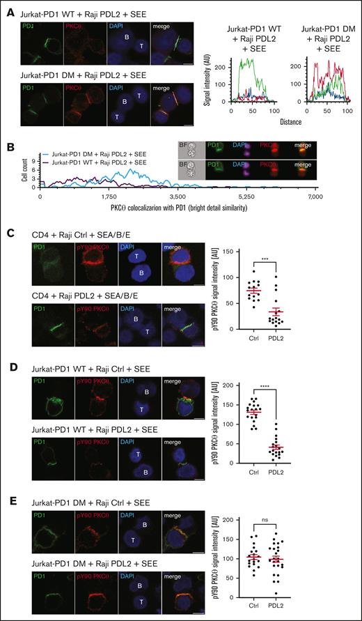 PD1-induced inhibition of PKCθ localization to the IS is SHP1/SHP2-dependent. (A) Left: immunofluorescent labeling of PD1 and PKCθ of Jurkat-PD1 WT cells (upper panel) and Jurkat-PD1 DM cells (lower panel) upon 60 minute of coculture with Raji PDL2 cells, preincubated with 6 ng/mL of SEE and mixed with Jurkat cells at a 1:1 ratio. Right: representative histogram of the colocalization profile prepared with RGB profiler plugin of ImageJ. Representative images of 3 independent experiments are shown. (B) ImageStream-based quantification of the colocalization between PD1 and PKCθ in Jurkat-PD1 WT cells and Jurkat-PD1 DM cells cocultured for 60 minutes with Raji PDL2 cells. Raji PDL2 cells were preincubated with 6 ng/mL of SEE and mixed with Jurkat cells at 1:1 ratio. Upon fixation and permeabilization, samples were stained for PKCθ, PD1, and nuclei (DAPI) and analyzed by Amnis Image Stream imaging flow cytometry. Left: histogram measuring the extent of signal overlap between PKCθ and PD1 with PD1 signal in the IS used as a mask; right: examples of images acquired. Representative results of 2 independent experiments are shown. (C) Left: immunofluorescent labeling of PD1 and pY90 PKCθ of human primary CD4 T cells upon 60 minute of coculture with Raji Ctrl cells (upper panel) or Raji PDL2 cells (lower panel). Raji cells were preincubated with 1 ng/mL of SEA/SEB/SEE and mixed with CD4 cells at a 1:2 (Raji:T cells) ratio. Right panel: quantification of total pY90 PKCθ signal intensity in T cells from 1 experiment. Representative results of 3 independent experiments are shown. Each dot represents the value from 1 primary T cell, 14 and 16 cells were quantified, respectively. (D) Left: immunofluorescent labeling of PD1 and pY90 PKCθ of Jurkat-PD1 WT cells upon 30 minutes of coculture with Raji Ctrl cells (upper panel) or Raji PDL2 cells (lower panel). Raji cells were preincubated with 6 ng/mL of SEE and mixed with Jurkat-PD1 WT cells at 1:1 ratio. Right panel: quantification of total pY90 PKCθ signal intensity in Jurkat-PD1 WT cells. Representative results of 3 independent experiments are shown. Each dot represents a value from 1 Jurkat cell, 19 and 19 cells were quantified, respectively. (E) Left: immunofluorescent labeling of PD1 and pY90 PKCθ of Jurkat-PD1 DM cells upon 60 minute of coculture with Raji Ctrl cells (upper panel) or Raji PDL2 cells (lower panel). Raji cells were preincubated with 6 ng/mL of SEE and mixed with Jurkat-PD1 DM cells at 1:1 ratio. Right panel: quantification of total pY90 PKCθ signal intensity in Jurkat-PD1 DM cells. Representative results of 3 independent experiments are shown. Each dot represents a value from 1 Jurkat cell, 19 and 24 cells were quantified, respectively. Scale bar, 5 μm. Graphs in panels C-E show mean value ± SEM. Statistical analysis was performed using a 2-tailed, unpaired t test. ∗∗∗∗P < .001; ∗∗∗P < .001; ns, not significant.