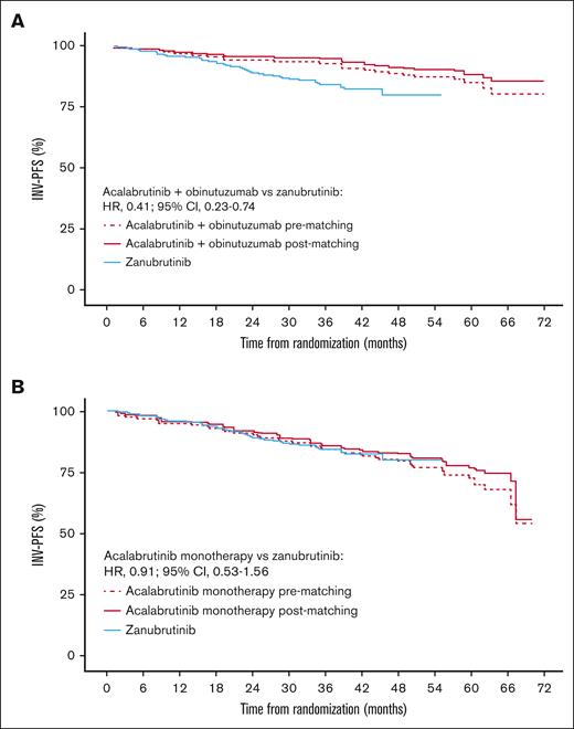 Efficacy results. Kaplan-Meier plot of INV-PFS for acalabrutinib plus obinutuzumab (A) and acalabrutinib monotherapy (B) before and after matching vs zanubrutinib.