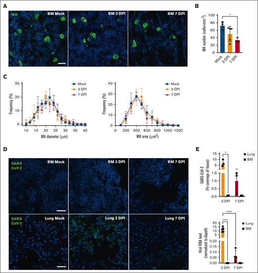 Megakaryocyte and SARS-CoV-2 detection in tissue during COVID-19. (A) Representative immunofluorescence images of BM MK during SARS-CoV-2 infection. Femurs of mice inoculated with SARS-CoV-2 (3 DPI or 7 DPI) or Mock-infected were stained with anti-CD41 (green) and the nuclei counterstained with Hoechst (blue; scale bar, 20 μm). (B) Megakaryocyte number was quantified in femurs and expressed as mean (± SD) × mm–2 of tissue. Statistics: 1-way ANOVA with Tukey's multiple comparisons, ∗P < .05; n = 3-5 per group. (C) Frequency distribution of MK size (diameter in μm; left) and area (surface in μm2 right panel) were analyzed, percentages of frequency are expressed as mean (± SD). Statistics, 2-way ANOVA, Mixed-effects analysis with Tukey's multiple comparisons test; n = 4-5 per group. (D) Representative immunofluorescence images of BM or lung during SARS-CoV-2 infection. SARS-CoV-2 was detected using anti–SARS-CoV-2 nucleocapsid (green), and nuclei were counterstained with Hoechst (blue) (scale bar, 25 μm). (E) Tissues from mice uninfected (Mock) or infected with SARS-CoV-2 for 3 days or 7 days were analyzed for the presence of SARS-CoV-2. Results are expressed as mean (± SD) of SARS-CoV-2 coverage (% of tissue; top; dotted line indicates the mean value obtained for mock tissues). Viral RNA levels were determined in BM by RT-ddPCR and compared with those in the lungs (bottom). SARS-CoV-2 E gene copies were normalized with Gapdh mRNA copies (n = 4-5 mice per condition). Results are expressed as mean (± SD). Statistics: 2-way ANOVA, mixed-effects analysis with uncorrected Fisher's LSD, ∗P < .05; ∗∗∗∗P < .0001; n = 3-5 per group. BM, bone marrow; DPI, day post-infection; LSD, least significant difference; MK, megakaryocytes; RT-ddPCR, reverse transcription digital droplet polymerase chain reaction.