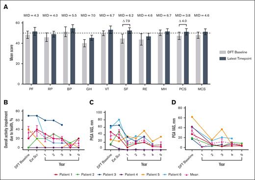 Changes in HRQoL over time. (A) Normed subscale and component scores from the SF-36 survey, with higher scores indicating greater HRQoL.26 MIDs for patients with IEI are from the literature.25 The latest time point for P1, P2, P3, P4, P5, and P6 are as follows: year 5, 5, 3, 5, 5, and 4, respectively. Differences in scores between DFT baseline and latest time point that exceed MIDs are illustrated with a delta symbol (Δ) followed by the value of the difference. Dotted line indicates general US population average. (B) Individual and mean WPAI-CIQ overall activity impairment because of health scores over time, with lower scores indicating less impairment because of health. n values for DFT baseline, Ext Scr and years 1, 2, 3, 4, and 5 are as follows: 6, 6, 6, 6, 6, 5, and 4, respectively. (C) Individual and mean patient general assessment scores are shown with lower scores indicating a reduction in disease activity. n values for DFT baseline, Ext Scr and years 1, 2, 3, 4, and 5 are as follows: 6, 6, 6, 6, 6, 5, and 4, respectively. (D) Individual and mean physician general assessment scores are shown with lower scores indicating a reduction in disease activity. There were no values reported for Ext Scr. n values for DFT baseline and years 1, 2, 3, 4, and 5 are as follows: 6, 1, 6, 6, 5, and 4, respectively. Error bars are standard error of the mean. BP, bodily pain; Ext Scr, extension screening; GH, general health; MCS, mental component score; MH, mental health; MID, minimally important difference; PCS, physical component score; PF, physical functioning; PGA, physician general assessment; PtGA, patient general assessment; RE, role (emotional); RP, role (physical); SF-36, Short-Form Health Survey 36; SF, social functioning; VT, vitality; WPAI-CIQ, Work Productivity and Activity Impairment Questionnaire plus Classroom Impairment Questionnaire.
