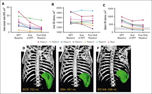 Changes in lymphoproliferation parameters. (A) Individual and mean untransformed SPD of index lymph nodes. n values for all time points are 6. Reference range (≤1.5 × 1.5 cm) not shown because up to 6 lymph nodes may be counted per patient.27 (B) Individual and mean liver volumes. n values for all time points are 6. (C) Individual and mean spleen volumes. n values for all time points are 6. Gray box indicates the reference range for adults.28 Imaging used to determine lymphoproliferation for each patient at their first OLE readout was completed around year 1 (either ED168 or 252) of the OLE study. (D-F) Representative radiographic renderings of spleen volume from P6 at (D) screen of DFT (SCR), (E) end of the DFT (D84), and (F) first extension study readout (ED168) in which splenomegaly was absent. P6 had a 2-month gap in treatment between the end of part 1 and entry into the extension. D, day; ED, extension day; SCR, screen.