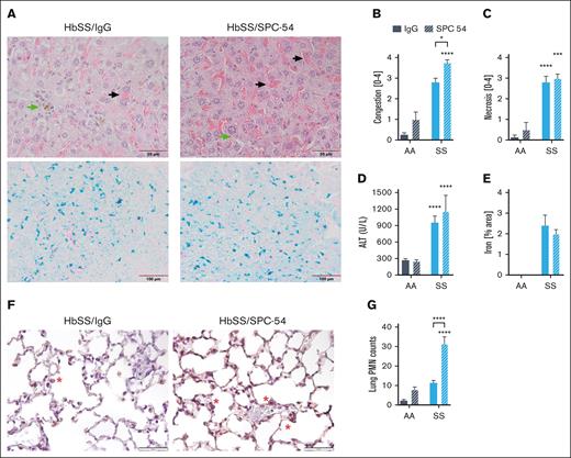 APC inhibition exacerbates hepatic congestion and lung neutrophil accumulation. (A) Representative images of liver sections from HbSS mice treated with IgG or SPC-54 stained with H&E (top) and Prussian Blue (bottom). Black arrow indicates sinusoidal congestion, and green arrow indicates iron-laden macrophages. Quantification of liver congestion (B) and liver necrosis (C) by 3 blinded observers. (D) Plasma levels of alanine aminotransferase (ALT). (E) Quantification of Prussian blue stain per total area. (F) Representative images of lung sections stained for neutrophils (brown). Scale bar, 50 μm; red asterisk (∗) denotes neutrophils. (G) Quantification of neutrophils (PMN) averaged over 10 high powered (40×) fields. Data are represented by mean ± SEM of 5 to 6 mice per group and analyzed by 2-way ANOVA and Tukey post hoc test. Asterisks directly above the bars indicate the statistical significance of SS mice to AA mice in the same treatment group. Asterisks over brackets indicate difference from IgG-treated mice. ∗P < .05; ∗∗P < .01; ∗∗∗P < .001; and ∗∗∗∗P < .0001. AA, controls; PMN, polymorphonuclear lymphocytes; SS, sickle mice.