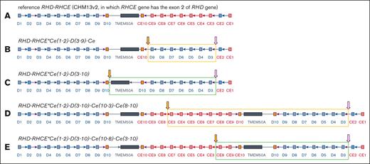 Reference RH and SV haplotype models. The purple border arrows indicate the joining point of homologous recombination; red border arrows indicate the joining point of nonhomologous junction; yellow filled arrows indicate the same joining points in different SV. (A) Reference RH haplotype model. (B-C) Models of the SV haplotype of the father. (D-E) Models of the SV haplotype of the mother.