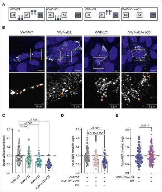 O-glycan clusters in VWF affect pseudo-WPB morphology. (A) Schematic representation illustrating OLG clustered around the VWF-A1 domain and the recombinant OLG mutants generated. (B) Immunofluorescent images of HEK293 cells expressing VWF-WT, VWF-ΔC2, VWF-ΔC1, and VWF-ΔC1+ΔC2. Orange arrowheads in zoomed images point to pseudo-WPBs (representative images of n = 3). Scale bars are set at 10 μm for overview images and at 5 μm for the zoomed regions. (C) Pseudo-WPB length in VWF-WT, VWF-ΔC2, VWF-ΔC1, and VWF-ΔC1+ΔC2 expressing HEK293 cells (n = 3; Kruskal-Wallis test; P = .01; P < .0001; and P < .0001). (D) Pseudo-WPB length in VWF-WT, VWF-WT treated with BG, and VWF-ΔC1+ΔC2 expressing HEK293 cells normalized to VWF-WT (n = 2 independent experiments; Kruskal-Wallis test with multiple comparisons; P = .0125; P < .0001; P = .3331). (E) Pseudo-WPB length in VWF-ΔC1+ΔC2 and VWF-ΔC1+ΔC2 treated with BG expressing HEK293 cells normalized to VWF-ΔC1+ΔC2 (n = 3 independent experiments; Mann-Whitney test; P = .0125; P < .0001; P = .3331).