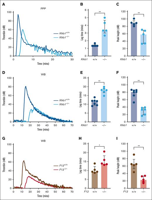 Effect of PK and FXII deficiency on contact pathway–initiated TG. (A-C) Representative silica-initiated TG curves in Klkb1+/+ and Klkb1–/– mice PPP (A) with quantification of TG lag time (B) and peak TG (n = 5 per group) (C). (D-F) Representative silica-initiated TG curves in Klkb1+/+ and Klkb1–/– mouse WB (D) with quantification of TG lag time (E) and peak TG (n = 6-7 per group) (F). (G-I) Representative silica-initiated TG curves in F12+/+ and F12–/– mouse WB (G) with quantification of TG lag time (H) and peak TG (n = 5 per group) (I). Data are presented as individual values with median and interquartile range. Data are analyzed with Mann-Whitney U tests; ∗P < .05; ∗∗P < .01.