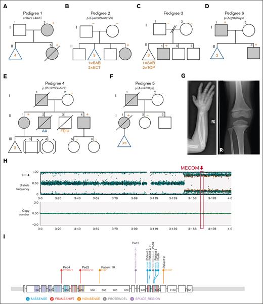 Pedigrees, phenotypes, and genotypes of families and individuals carrying rare germ line MECOM variants. (A-F) Pedigrees with germ line MECOM variants. Affected individuals (gray), MECOM mutation carriers (+), MECOM WT (−). (G) X-ray images from 3-II-4 demonstrating RUS and absent patella. (H) Copy neutral loss of heterozygosity in 3-II-4 across chromosome 3q encompassing the MECOM germ line variant and leading to somatic genetic rescue. (I) Distribution of germ line MECOM variants (NM_004991.4) visualized using ProteinPaint web application. AA, aplastic anemia; ECT, ectopic pregnancy; FDIU, fetal death in utero; SAB, spontaneous abortion; TOP, termination of pregnancy.