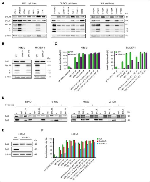 BAX belongs to key mediators of cytotoxicity triggered by the combination of VEN and A1155463 in BIM-deficient lymphoma and leukemia cells. (A) Western blot analysis of selected BCL2 family proteins in the tested lymphoma and leukemia cell lines. (B) Western blot confirmation of absence of BIM and/or BAK proteins in the HBL-2 and MAVER-1 lymphoma cell clones with K/O of BIM and BAK genes. (C) K/O of BIM in lymphoma cell lines (HBL-2 and MAVER-1 BIM K/O clones) resulted in increased VEN-R, whereas sensitivity to the combination was largely retained; sensitivity of wild-type (WT) cells is shown for comparison. (D) Immunoprecipitations (IPs) of 2 BIM-deficient cell lines (MINO and Z-138) exposed for 3 hours to A1155463 (1000 nM) or medium only with anti–BCL-XL and anti-BCL2 antibodies and subsequent western blot detection of BAX and BAK proteins bound on BCL-XL and BCL2. (E) Western blot confirmation of absence of BAX protein expression in HBL-2 cell clone with K/O of BAX gene. (F) Apoptosis essays after exposure to the defined VEN and A1155463 concentrations reveal that HBL-2 cells with BAX K/O are significantly more resistant to VEN and to the VEN + A1155463 combination than HBL-2 cells with BAK K/O.