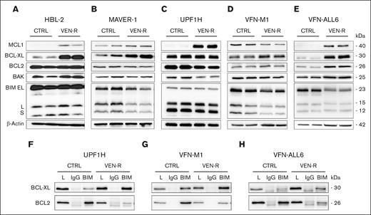 Sequestration of BIM to upregulated BCL-XL belongs to hallmarks of acquired VEN resistance. (A-E) Western blot analysis of selected BCL2 family proteins (MCL1, BCL-XL, BCL2, BAK, and BIM) in cell lysates isolated from the subcutaneous cell line–based xenograft (CDX) tumors (HBL-2, MAVER-1, and UPF1H), and subcutaneous patient-derived xenograft (PDX) tumors (VFN-M1 and VFN-ALL6) obtained from the untreated animals (CTRL) and from the animals with acquired VEN resistance. (F-H) IP of the selected CDX or PDX tumors with anti-BIM antibody and subsequent detection of BCL-XL and BCL2 bound on BIM; 1 CDX model (UPF1H) and 2 PDX models (VFN-M1 and VFN-ALL6) were analyzed; the mice were euthanized and tumors analyzed 24 hours after the last dose of VEN.