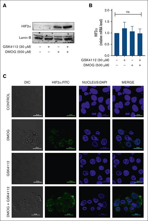 Effect of Rev-erbα on HIF2α translocation. (A) Immunoblot analysis of HIF2α in the nuclear extract in HepG2 cells. (B) Expression of HIF2α in HepG2 cells as measured by qRT-PCR. (C) Image analysis of HIF2α protein translocation by confocal microscopy as observed in HepG2 cells treated with DMOG or GSK4112 or combination for 24 hours. Data are representative and mean ± SD from 3 independent experiments.