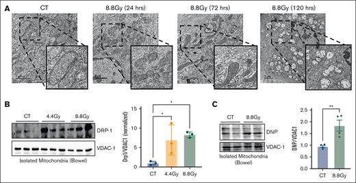 TBI induces mitochondrial fission and oxidative stress in the intestinal epithelium. The small bowel of BALB/c mice treated with TBI was resected at the indicated time points and evaluated for changes in mitochondrial architecture. (A) Representative electron micrograph for each time point is shown. (B-C) Enriched mitochondrial fractions isolated 24 hours after TBI from the small bowel of mice. (B) A representative western blot probed with antibodies against dynamin-related protein 1 (DRP1) for mitochondrial fission, and VDAC-1 for total mitochondrial content (left) and densitometric protein quantification (n = 3; right) is shown. (C) A representative western blot derivatized with dinitrophenylhydrazine (DNP) and probed with antibodies against DNP for protein carbonylation and VDAC-1 for total mitochondrial content (left) and densitometric protein quantification (n = 3; right) is shown. CT, control (nonirradiated) mice; ∗P < .05, and ∗∗P < .01; n, number of mice). VDAC-1, Voltage-dependent anion-selective channel 1.