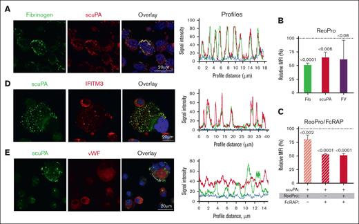 αIIbβ3 mediates uptake of scuPA by CD34+ MKs. (A) Confocal images of day-11 CD34+ MKs loaded with Alexa-488 fibrinogen and Alexa-586 scuPA for 24 hours. Colocalization of scuPA and fibrinogen is depicted in yellow in the overlay panel (right). DAPI (blue) depicts the nuclei. Scale bar is shown. For quantitation of colocalization, see also Table 1. Profile measurements are as in Figure 2A. (B) Inhibition of scuPA, fibrinogen, and FV (200 nM each) uptake by ReoPro monoclonal antibody (200 μg/mL). (C) A similar study as in panel B but for scuPA alone and inhibition was by ReoPro (200 μg/mL) and/or FcRAP (200 μg/mL). In both, ordinate denotes percent of uptake inhibition by ReoPro and/or FcRAP. Data were analyzed using the 2-way ANOVA. Mean ± 1 SD is shown. n = 3 to 4 independent studies. Data were analyzed using a 2-way Student t test. (D-E) Confocal studies of MKs loaded with scuPA (600 nM) and stained with Alexa-488 mouse anti-uPA monoclonal antibody, and (D) anti-IFITM3 rabbit polyclonal antibody, (E) anti-VWF antibody rabbit polyclonal antibody, followed by Alexa-555 or Alexa-647 goat anti-rabbit polyclonal antibody (red). Nuclei were stained blue by DAPI. For quantitation of overlap, see also Table 1. Profile measurements in panels D-E are as in Figure 2A.
