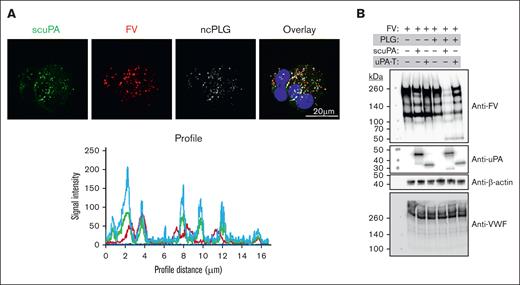 Effects of PLG on uPA-MKs. (A) Confocal images of day-11 CD34+ MKs preincubated for 24 hours with Alexa-488 scuPA (green), Alexa-568 FV (red), and Alexa-647 ncPLG (white). Nuclei were stained blue by DAPI. For quantitation of overlap, see also Table 1. Profile measurements are as in Figure 2A. (B) WB analysis of lysates prepared from day-11 CD34+ MKs with or without loading with enzymatically active PLG (20 μg/mL) on day 10 for 18 hours followed by a wash and incubation with scuPA or uPAT (200 nM each) and/or FV (400 nM) for 24 hours. WB membranes were probed with mouse monoclonal antibodies recognizing reduced FV, nonreduced uPA, and rabbit polyclonal antibody recognizing reduced VWF and β-actin (nonconjugated and HRP-conjugated, respectively).