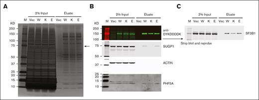 The E592K variant preserves association of SF3B1 with SUGP1. HEK293T cells were transfected with His6-FLAG-SF3B1 variants and subjected to affinity purification with anti-DYKDDDDK (FLAG) antibody. (A) Silver-stained protein gel, with arrow pointing to the size of SUGP1, which is decreased in K700E but not E592K eluate. (B) Western blot showing decreased SUGP1 in K700E, but not E592K, eluate. PHF5A is present with all SF3B1 variants. (C) Reprobing with anti-SF3B1 shows native and His6-FLAG–tagged protein levels. E, E592K; K, K700E; KD, kilodaltons; M, marker; Vec, vector only; W, wild type SF3B1.