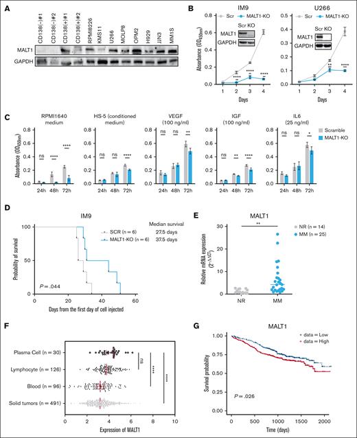 MALT1 is highly expressed in MM cells. (A) Whole-cell lysates of human myeloma cell lines, 2 CD138+ primary MM cells, and 2 CD138− primary BM mononuclear cells (BMMCs) were subjected to WB analysis and probed with indicated antibodies, with GAPDH as a loading control. (B) IM9 and U266 cell lines were transduced with single guide RNA (sgRNA) targeting MALT1. WB analysis of MALT1 in MALT1-KO cells (labeled as KO) compared with MALT1-scramble cells (labeled as Scr). Cell viability was measured daily by CCK-8 assay. Data are shown as optical density (OD) value at 450 nm. (C) Scramble and MALT1-KO cells were cultured with RPMI-1640 medium, HS-5 conditional medium, VEGF (100 ng/mL), insulin-like growth factor (IGF; 100 ng/mL), and IL-6 (25 ng/mL). Cell viability was measured by CCK8 assay at 24, 48, or 72 hours, and OD value at 450 nm is shown. (D) NSG mice were inoculated intravenously with scramble cells (n = 6) and MALT-KO IM9 cells (n = 6). The survival of mice was analyzed by Kaplan-Meier survival curves; hazard ratio (HR), 0.3759; 95% confidence interval (CI), 0.11-1.33. (E) The mRNA level of MALT1 in BMMCs from patients with MM or normal healthy donors (NR) was measured by quantitative reverse transcription polymerase chain reaction assay (qRT-PCR). (F) The dot blot shows the mRNA expression level of MALT1 in MM and other tumors. Data were obtained from Depmap. (G) Correlation of MALT1 with overall survival was investigated in the MMRF CoMMpass trial (772 newly diagnosed patients). No significance (ns), P > .05; ∗P < .05; ∗∗P < .005; ∗∗∗P < .001; and ∗∗∗∗P < .0001.