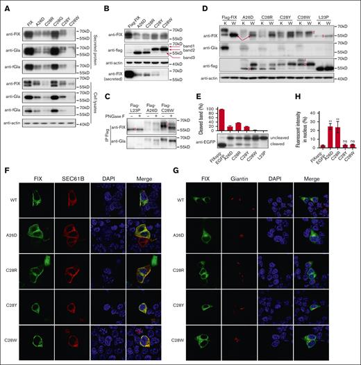 Missense variants in c-region differently disturb the SP function. (A) The intracellular and secreted FIX antigens with c-region variants were detected by antibodies of anti-FIX, anti-Gla, and anti-FIX with functional Gla domain (anti-fGla), respectively. The constructs were based on FIX. The β-actin was used as a loading control for cell lysate samples. (B) The c-region variants had several forms of the SP-retained FIX. The constructs were based on Flag-FIX construct. The anti-flag antibody was used to detect the different forms of the SP-retained FIX, which were indicated by the band 1, 2, and 3. (C) Posttranslational modifications of glycosylation and γ-carboxylation lead to different forms of the SP-retained FIX. Band 1 was glycosylated and γ-carboxylated, band 2 was glycosylated but not γ-carboxylated, and band 3 had neither modification. (D) Comparison of protein expression patterns between vitamin K and warfarin treatment. The different forms of the SP-retained FIX were indicated by 1, 2, and 3. K and W indicated that the cells were treated by vitamin K (10 μM) or warfarin (10 μM). Warfarin was used to inhibit γ-carboxylation. The red arrows indicate the SP-cleaved and uncarboxylated FIX. (E) The c-region variants differently affected the SP cleavage. The HEK293T cells were transfected with FIXsgp-EGFP constructs and cultured in medium with 10 μM warfarin. The immunoblotting was performed by anti-EGFP antibody. The L23P was used as the SP-retained (uncleaved) control. The intensity of the SP cleaved and uncleaved bands was quantified by ImageJ, and the percentage of cleaved band was calculated from 3 independent experiments by dividing the cleaved band intensity to the total intensity of the cleaved and uncleaved bands. (F-G) The effect of c-region missense variants on subcellular localization of FIXspg-EGFP reporter. Sec61B-mcherry and mScarlet-Giantin were used as an ER marker and Golgi marker, respectively. Nuclei were stained with DAPI. Cells were cultured in a medium with 10 μM vitamin K. (H) Quantification of fluorescent intensity in nucleus from panels F-G. Green fluorescent intensity of FIXspg-EGFP in the whole cell and nucleus was quantified by ImageJ. The percentage of fluorescent intensity in nucleus was calculated by dividing the fluorescent intensity in nucleus to that in the whole cell. Six to 10 cells were analyzed for each construct, and t test was performed between WT and variants by GraphPad Prism 7. ns indicates no significant difference (P > .05); ∗∗P < .01.