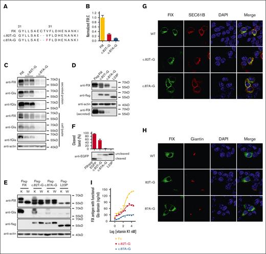 Characterizations of FIX variants encoded by two 6-nt deletion splicing products. (A) Comparing the encoded protein sequences of 2 major FIX splicing variants caused by c.82T>G and c.87A>G. (B) Relative FIX:C of both splicing variants of c.82T>G and c.87A>G. Error bars were standard deviation calculated from 3 repeats. (C) The intracellular expressed and secreted FIX antigens of two 6-nt deletion splicing variants were detected by immunoblotting. (D) Two 6-nt deletion splicing variants disturbed the SP cleavage. (E) Comparison of protein expression patterns between vitamin K and warfarin treatment. K and W indicated that the cells were treated by vitamin K (10 μM) or warfarin (10 μM). Warfarin was used to inhibit γ-carboxylation. (F) The effect of splicing variants on the SP cleavage efficiency. The HEK293T cells were transfected with FIXsgp-EGFP constructs and cultured in medium containing 10 μM warfarin. The L23P was used as the SP-retained control (uncleaved). The intensity of the SP cleaved and uncleaved bands was quantified by ImageJ. The percentage of cleaved band was calculated from 3 independent experiments by dividing the cleaved band intensity to the total intensity of the cleaved and uncleaved bands. (G-H) The effect of the two 6-nt deletion splicing variants on subcellular localization of FIXspg-EGFP reporter. Sec61B-mcherry and mScarlet-Giantin were used as an ER marker and Golgi marker, respectively. Nuclei were stained with DAPI. Cells were cultured in a medium with 10 μM vitamin K. (I) Vitamin K level increased the FIX antigen with functional Gla domain in both splicing variants. The anti-FIX with functional Gla domain (anti-fGla) was used as capture antibody for ELISA, and the HRP-conjugated sheep anti-human FIX (SAFIX-HRP) was used as the detection antibody.