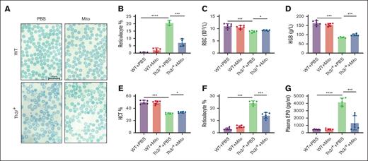 Mitoxantrone relieved anemia in β-thalassemic mice. (A) Representative pictures (scale bar, 20 μm) of circulating erythrocytes, stained with brilliant cresyl blue. (B) Statistics of reticulocyte identified by brilliant cresyl blue staining. Standard hematological tests of RBC counts (C), hemoglobin concentration (HGB; D), hematocrit (HCT; E), and reticulocyte ratio (F). (G) Plasma EPO concentration evaluated by enzyme-linked immunosorbent assay. The groups mean WT and HbbTh3/+ (Th3/+) mice treated with either mitoxantrone (Mito) or PBS. The bar plot represents the mean ± standard deviation (SD) of samples (n = 6-8 mice per group). ∗P < .05; ∗∗P < .01; ∗∗∗P < .001; ∗∗∗∗P < .0001.